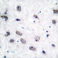 Alpha-adducin (Phospho-S726/713) Antibody
