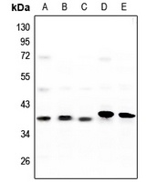 CK1 alpha Antibody