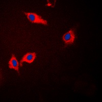 CK1 alpha Antibody