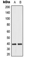 DUSP1/4 Rabbit Polyclonal Antibody