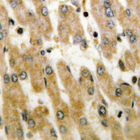 DUSP1/4 Rabbit Polyclonal Antibody