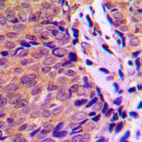 Ah Receptor (Phospho-S36) Antibody
