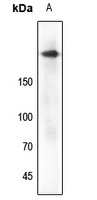 IGF1 Receptor (Phospho-Y1161) Antibody