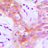 IGF1 Receptor (Phospho-Y1161) Antibody