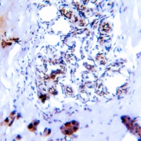 SMAD2/3 (Phospho-T8) Antibody