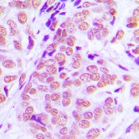 NFIA Rabbit Polyclonal Antibody