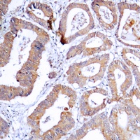 MKK1/2 (Phospho-S218/222) Antibody