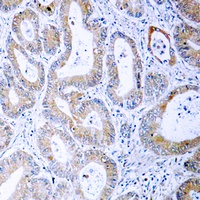 MKK1/2 (Phospho-S222/226) Antibody