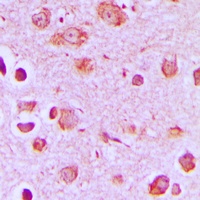 Synaptotagmin Rabbit Polyclonal Antibody