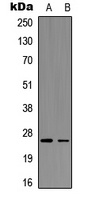 AID Rabbit Polyclonal Antibody