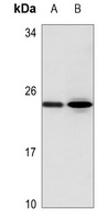 AID Rabbit Polyclonal Antibody