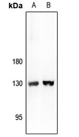 ARHGAP20 Rabbit Polyclonal Antibody