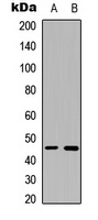 B4GALT6 Rabbit Polyclonal Antibody