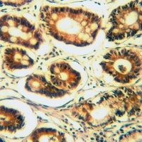 B4GALT6 Rabbit Polyclonal Antibody