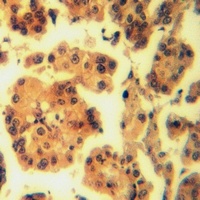 Calpain 3 Rabbit Polyclonal Antibody