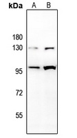 CD85j Rabbit Polyclonal Antibody