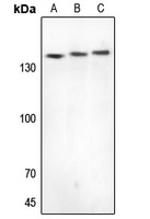 CYFIP1 Antibody [KO/KD Validated]