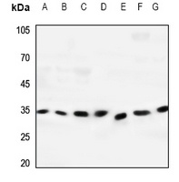 Dectin 2 Rabbit Polyclonal Antibody
