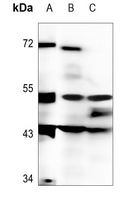 DMRTA1 Antibody