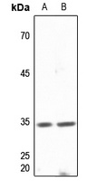 DNAJB2 Rabbit Polyclonal Antibody