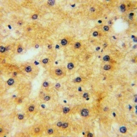 EPHA1 (Phospho-Y605) Antibody