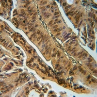 EYA1 Rabbit Polyclonal Antibody