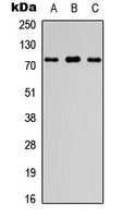 FIGNL1 Rabbit Polyclonal Antibody
