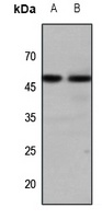 GALR1 Rabbit Polyclonal Antibody