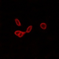 GALR1 Rabbit Polyclonal Antibody