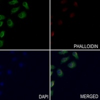 HLA-DQB1 Rabbit Polyclonal Antibody