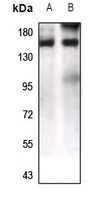 LPHN1 Rabbit Polyclonal Antibody