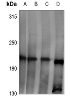 LPHN2 Rabbit Polyclonal Antibody