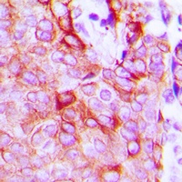 LPHN2 Rabbit Polyclonal Antibody