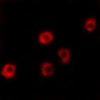 LPHN2 Rabbit Polyclonal Antibody