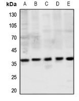 MAS1L Rabbit Polyclonal Antibody