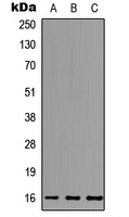 MCFD2 Rabbit Polyclonal Antibody