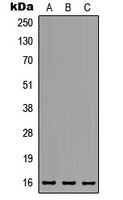 MED31 Rabbit Polyclonal Antibody