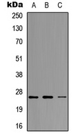Neurogenin 1 Rabbit Polyclonal Antibody