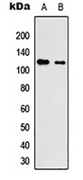 Neuroligin 3 Rabbit Polyclonal Antibody