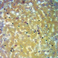 Orosomucoid 1 Rabbit Polyclonal Antibody
