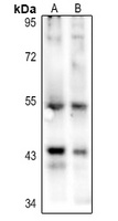 p53 (Acetyl-K386) Rabbit Polyclonal Antibody