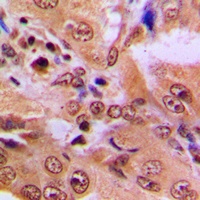 p53 (Acetyl-K386) Rabbit Polyclonal Antibody