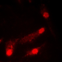 p53 (Acetyl-K386) Rabbit Polyclonal Antibody