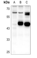 PDP1 Rabbit Polyclonal Antibody