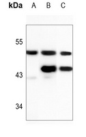 PICK1 Rabbit Polyclonal Antibody