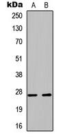 PLUNC Rabbit Polyclonal Antibody