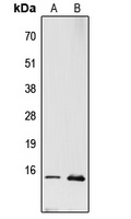 RPL22 Rabbit Polyclonal Antibody