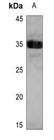 SCNM1 Rabbit Polyclonal Antibody