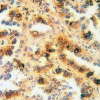 SFTPA1 Antibody