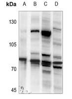 TBK1 Rabbit Polyclonal Antibody
